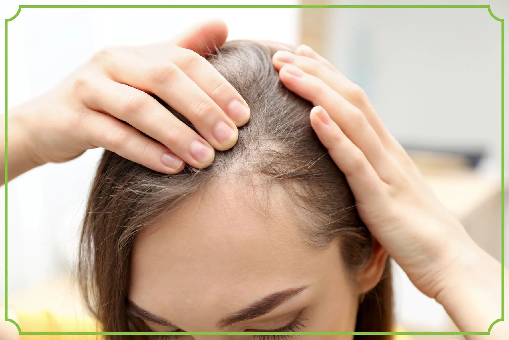 Co działa na porost włosów Naturalne metody i produkty - obrazek wyróżniający