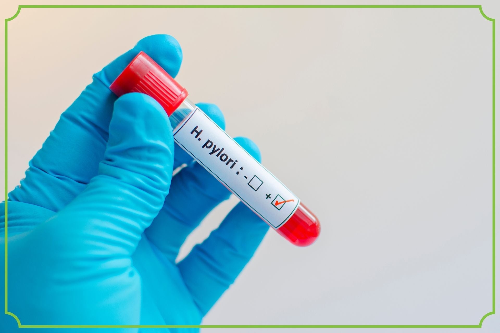 Dieta wspierająca walkę z Helicobacter pylori-jakie produkty wybierać - obrazek wyróżniający