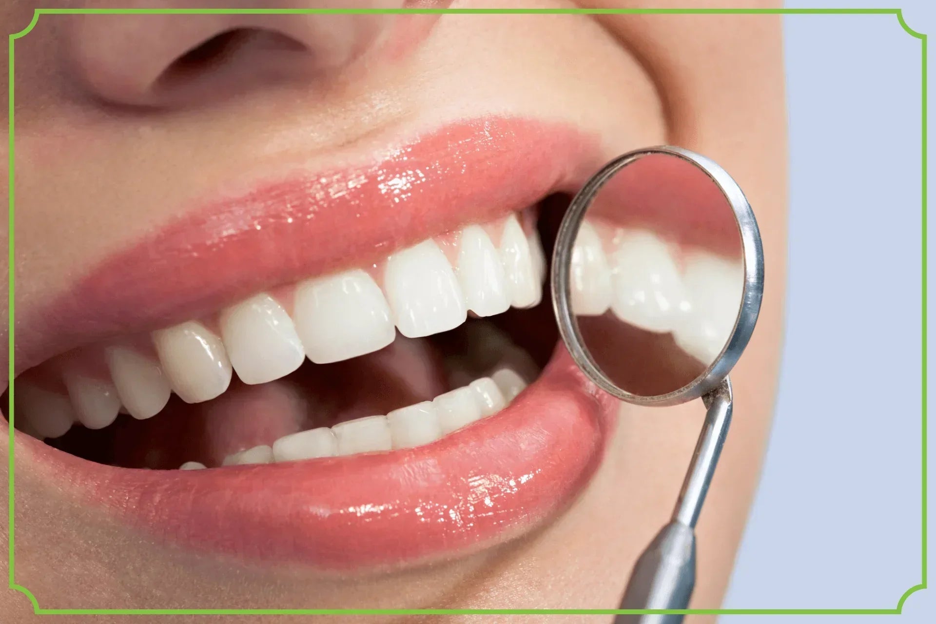 Biała dieta - co jeść, aby utrzymać białe zęby po wybielaniu - obrazek wyróżniający