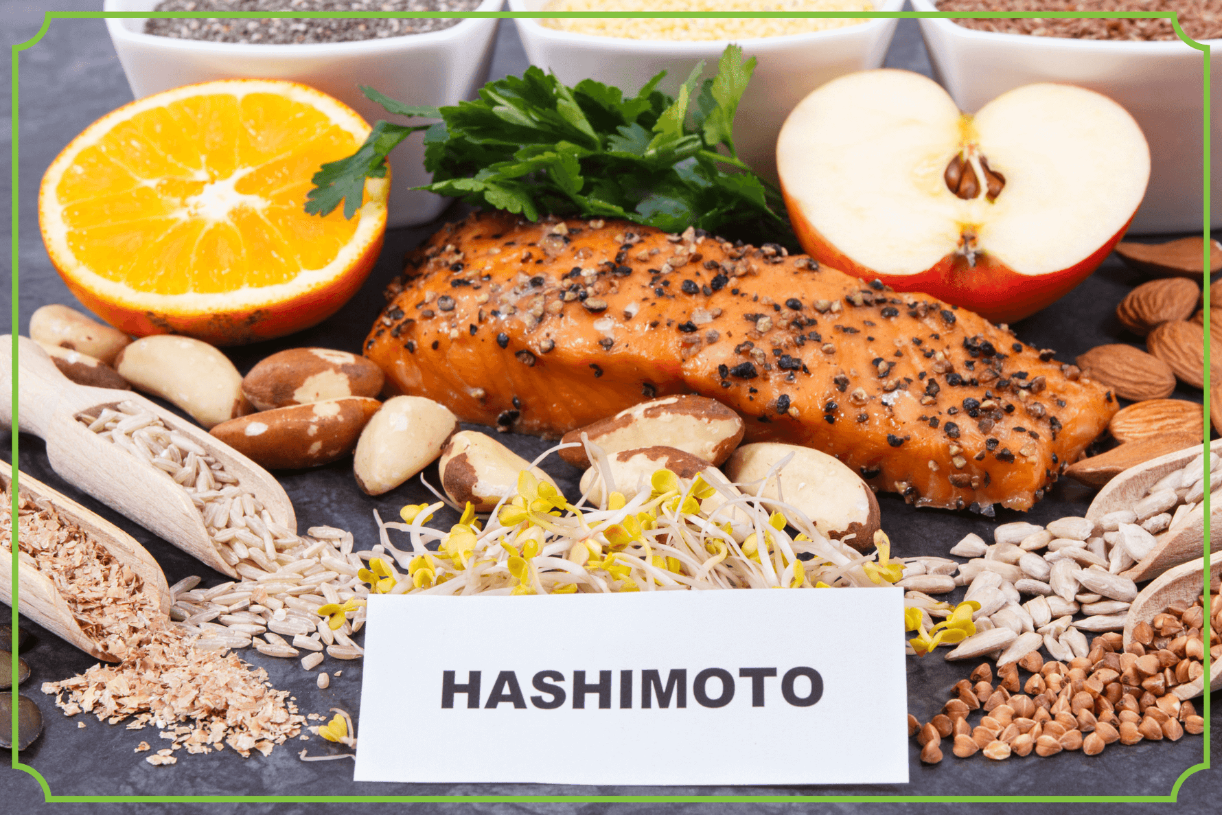 Choroba Hashimoto – jak skutecznie ją leczyć?