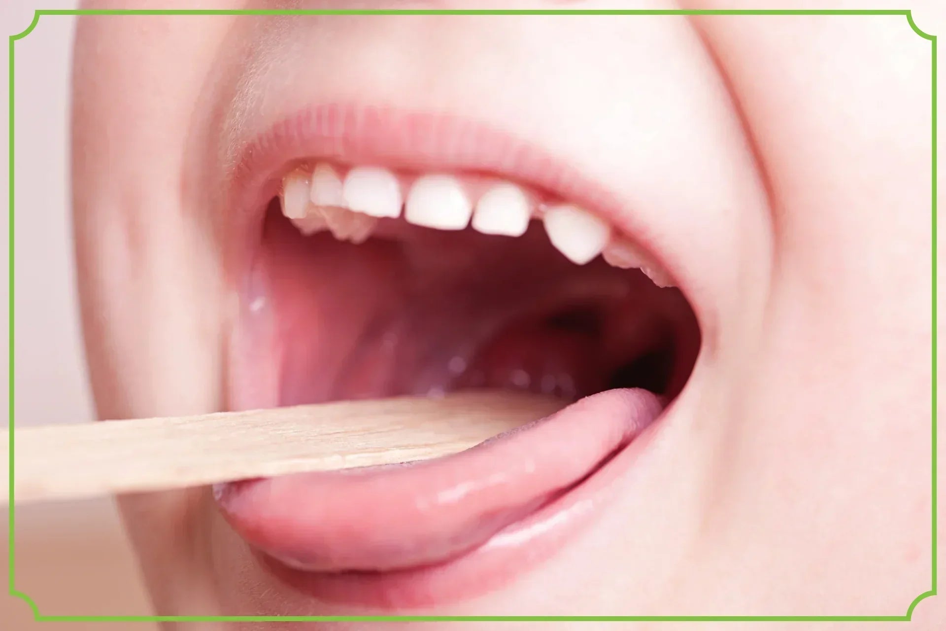 Infekcje u dzieci – jak wzmocnić ich odporność? obrazek wyróżniający