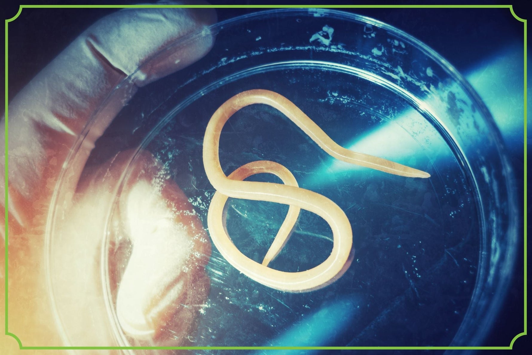 Jak rozpoznać pasożyty w organizmie? Objawy, leczenie i profilaktyka obrazek wyróżniający