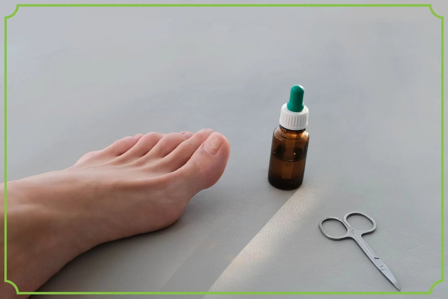 Onycholiza paznokci – co to jest i jak ją leczyć? - obrazek wyróżniający