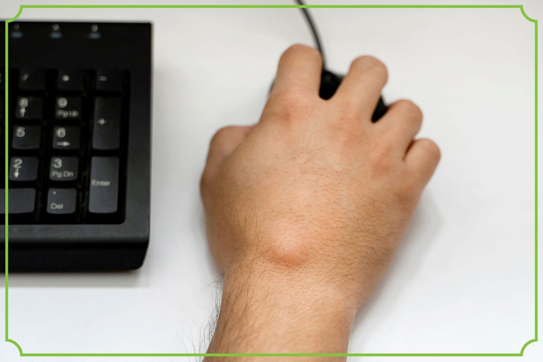 Tłuszczak: czym jest, jak wygląda i kiedy wymaga leczenia?