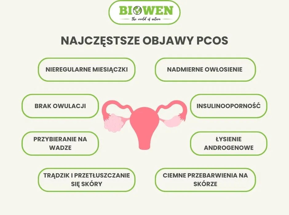 Najczęstsze objawy PCOS - infografika