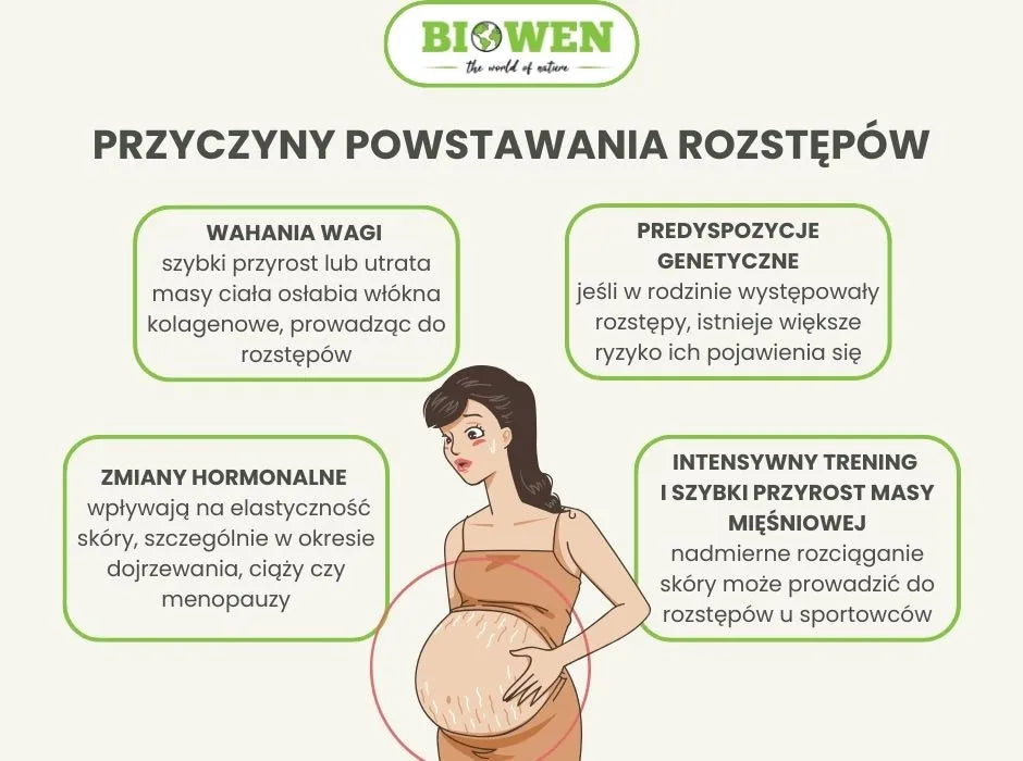 Przyczyny powstawania rozstępów - infografika