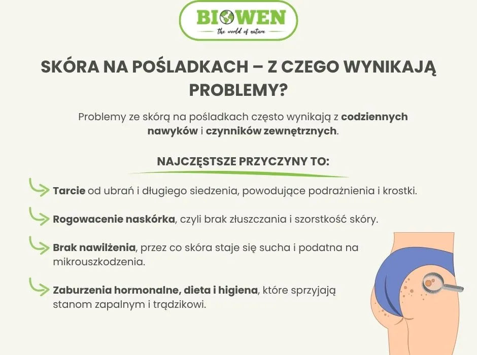 Skóra na pośladkach–z czego wynikają problemy - infografika