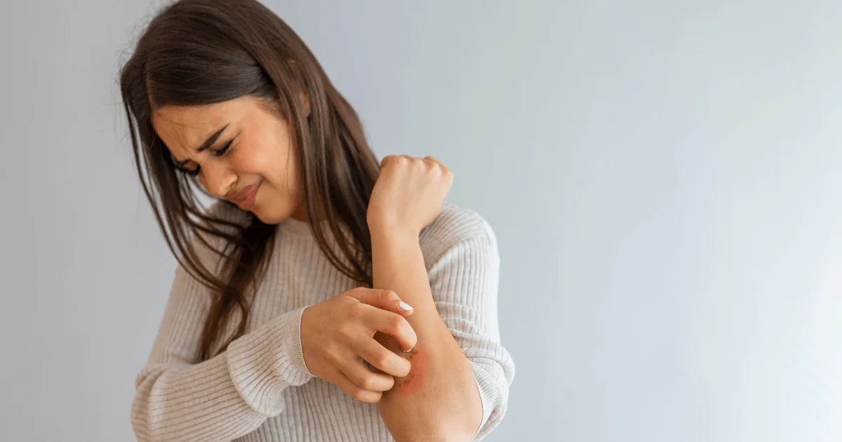 Alergie skórne - zdjęcie poglądowe