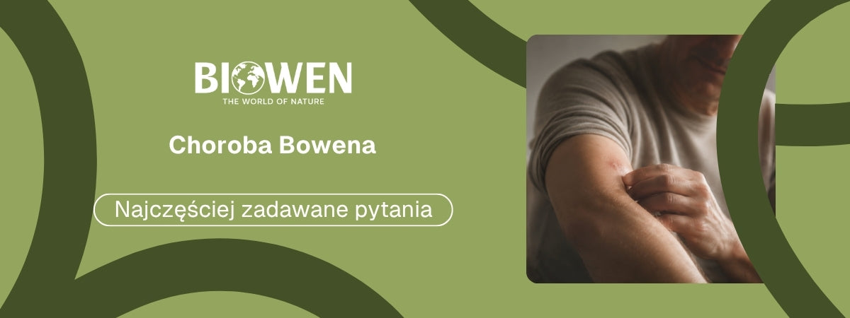 Choroba Bowena FAQ - obrazek poglądowy