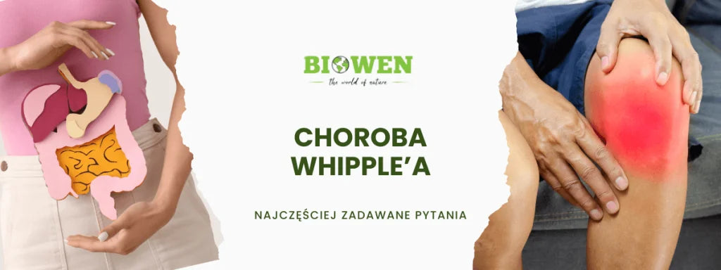 Choroba Whipple'a FAQ - obrazek poglądowy