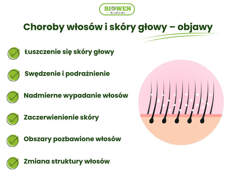 Choroby włosów i skóry głowy – objawy - infografika