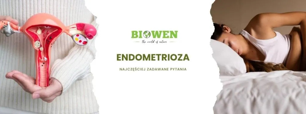 endometrioza faq - najczęściej zadawane pytania