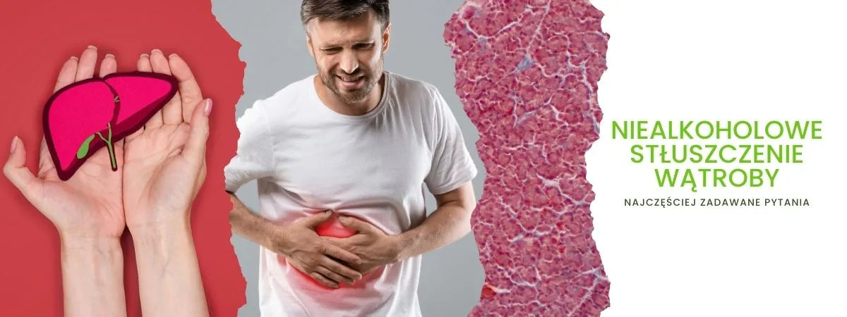 niealkoholowe stłuszczenie wątroby najczęściej zadawane pytania