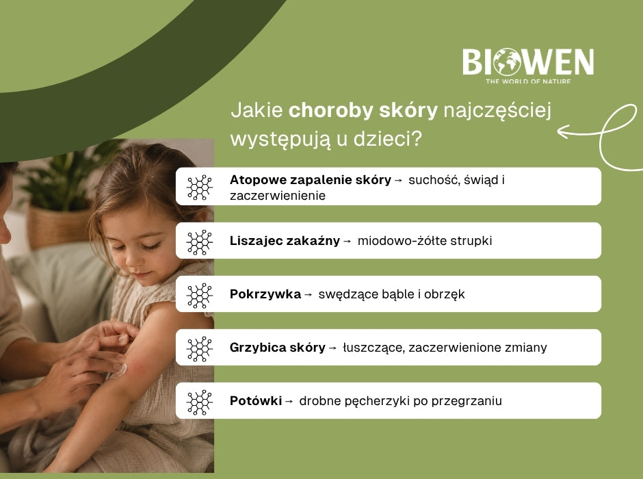 Jakie choroby skóry najczęściej występują u dzieci? - infografika