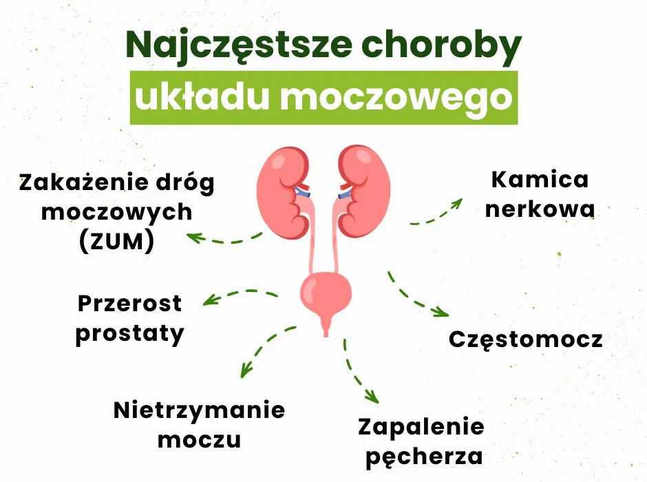 Najczęstsze choroby układu moczowego - infografika