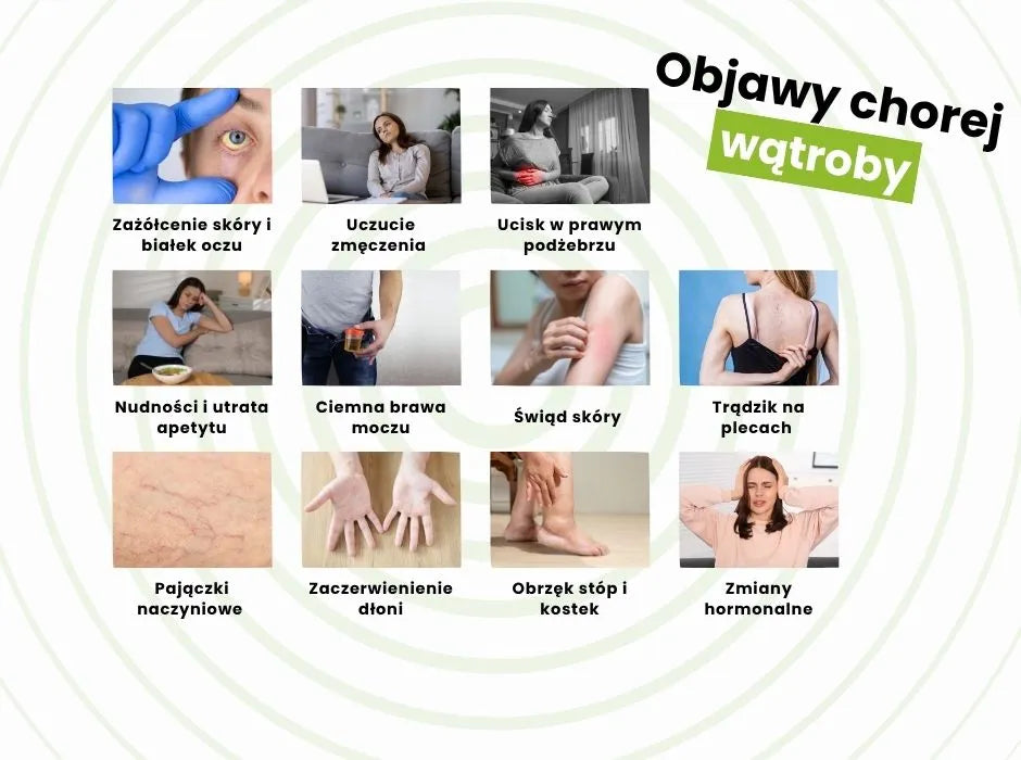 objawy chorej wątroby typowe i nietypowe - infografika