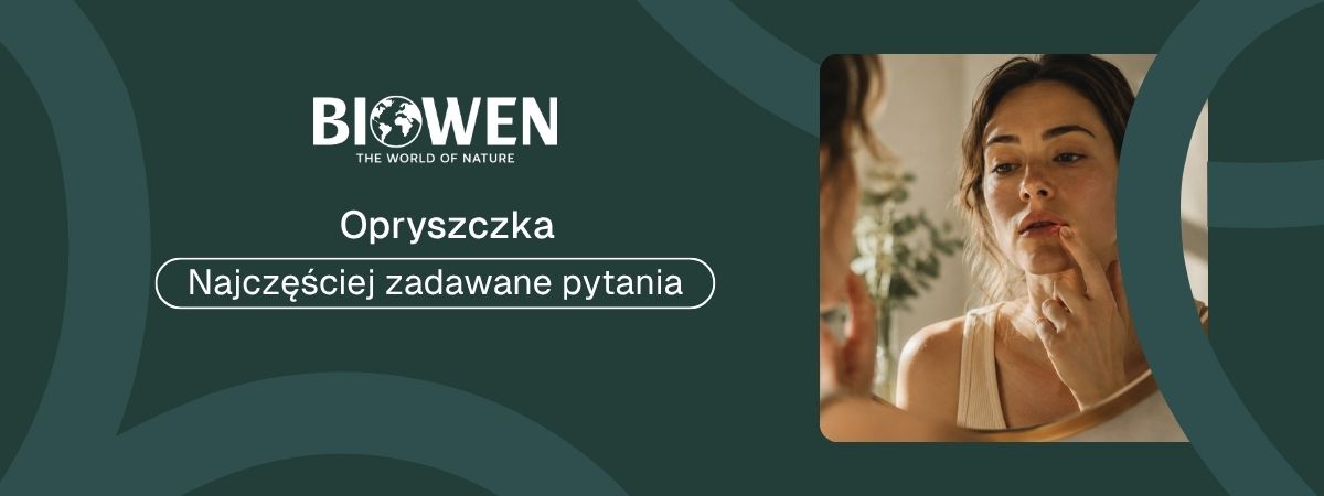 Opryszczka FAQ - obrazek poglądowy