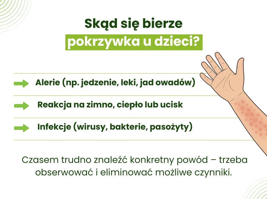 Pokrzywka u dzieci przyczyny - infografika