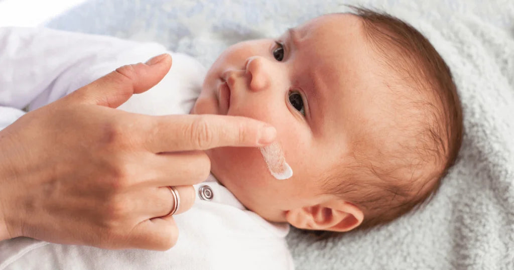 Pokrzywka u dziecka jak leczyć - zdjęcie poglądowe