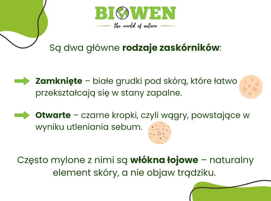 Rodzaje zaskórników - infografika