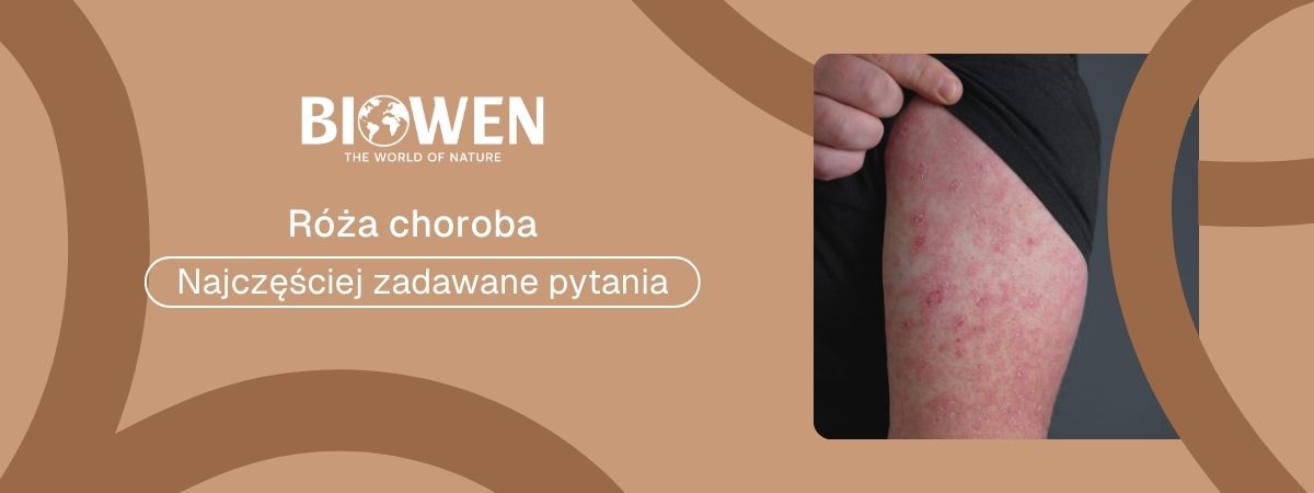 róża choroba faq - najczęściej zadawane pytania