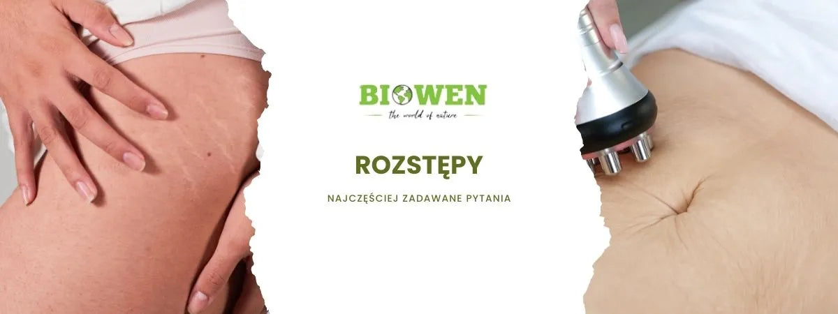 rozstępy faq - najczęściej zadawane pytania