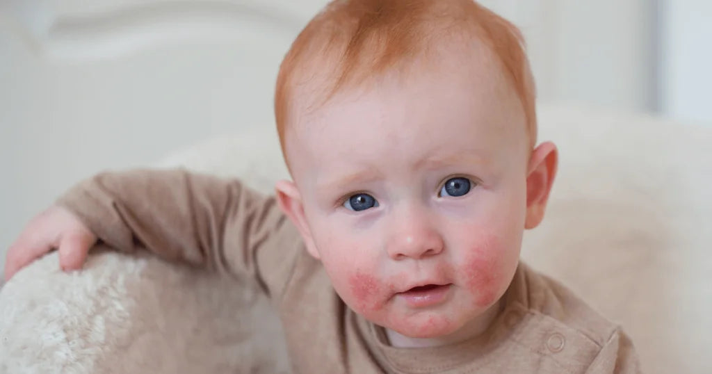 Skaza białkowa u dzieci - zdjęcie poglądowe