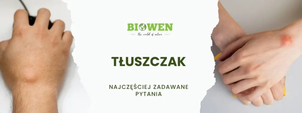 Tłuszczak FAQ - obrazek poglądowy