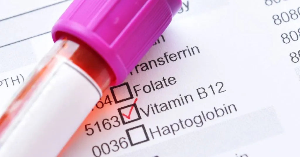 Witamina B12 badanie - zdjęcie poglądowe