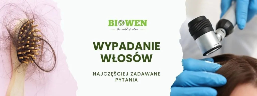 Wypadanie włosów FAQ - obrazek poglądowy