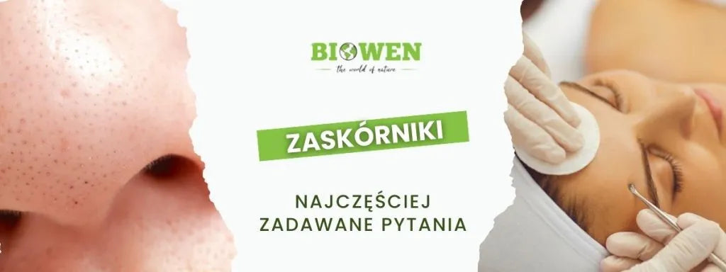 Zaskórniki FAQ - obrazek poglądowy