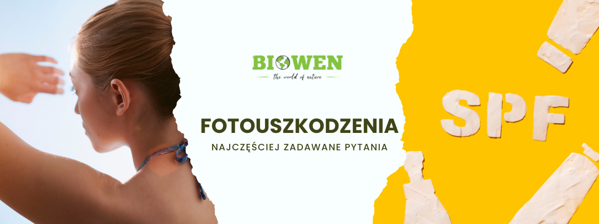 Fotouszkodzenia FAQ - zdjęcie poglądowe