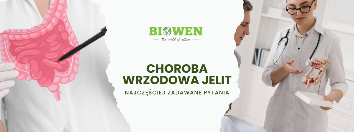 Choroba wrzodowa jelit FAQ - obrazek poglądowy