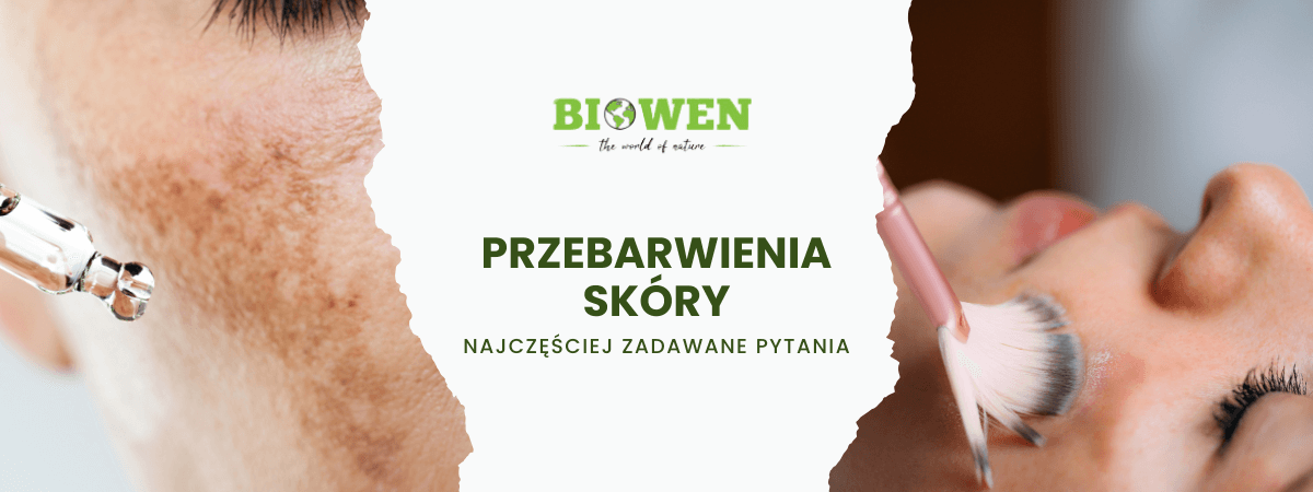 Przebarwienia skóry FAQ - obrazek poglądowy