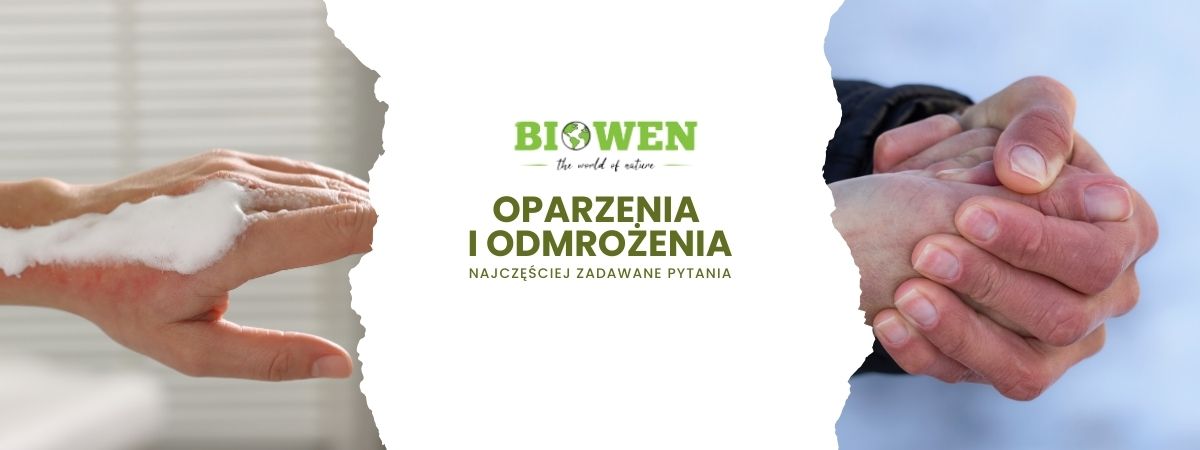 oparzenia i odmrożenia faq - najczęściej zadawane pytania