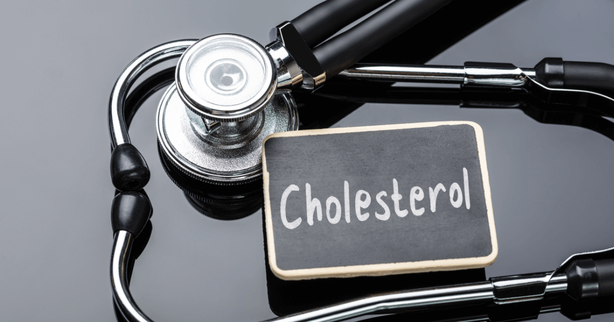 Cholesterol badania - zdjęcie poglądowe