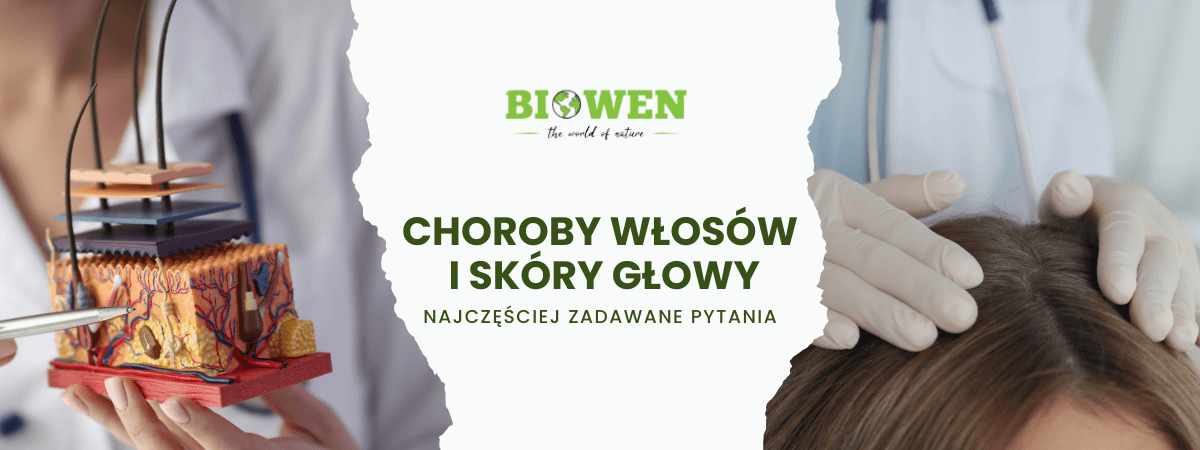 Choroby włosów i skóry głowy FAQ - obrazek poglądowy