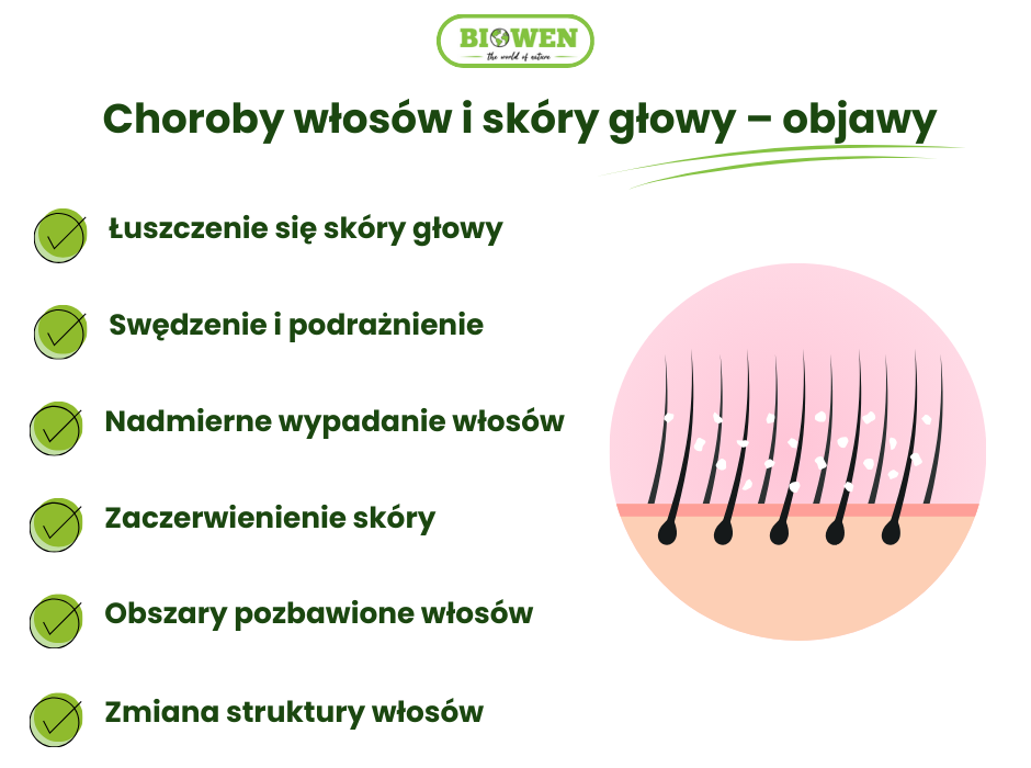 Choroby włosów i skóry głowy – objawy - infografika