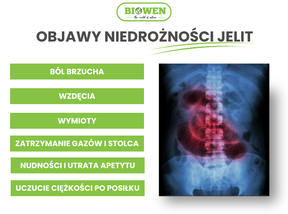 Objawy niedrożności jelit - infografika