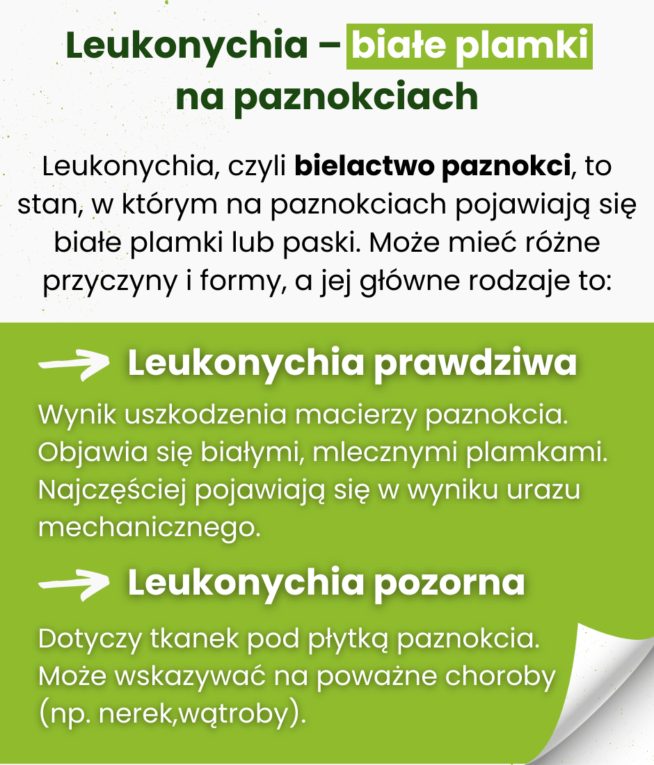 Leukonychia - infografika