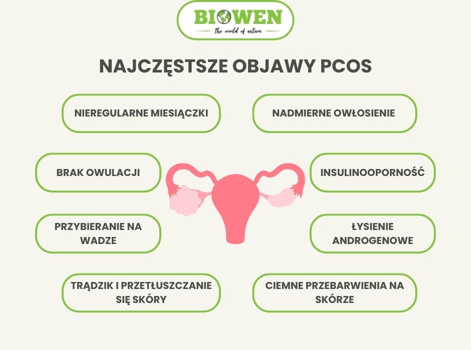 Najczęstsze objawy PCOS - infografika