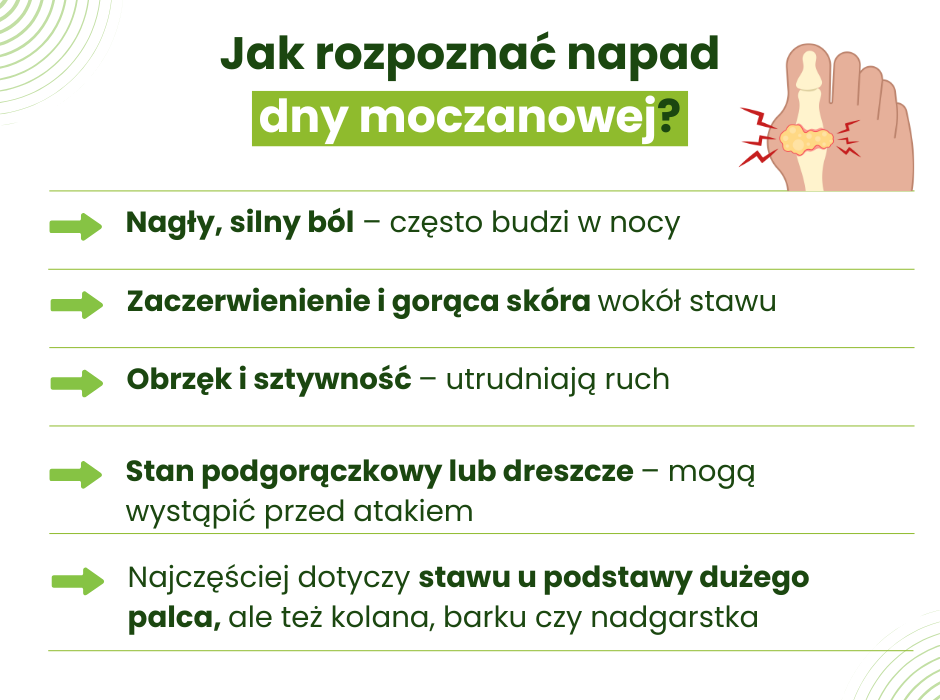 Dna moczanowa objawy - infografika
