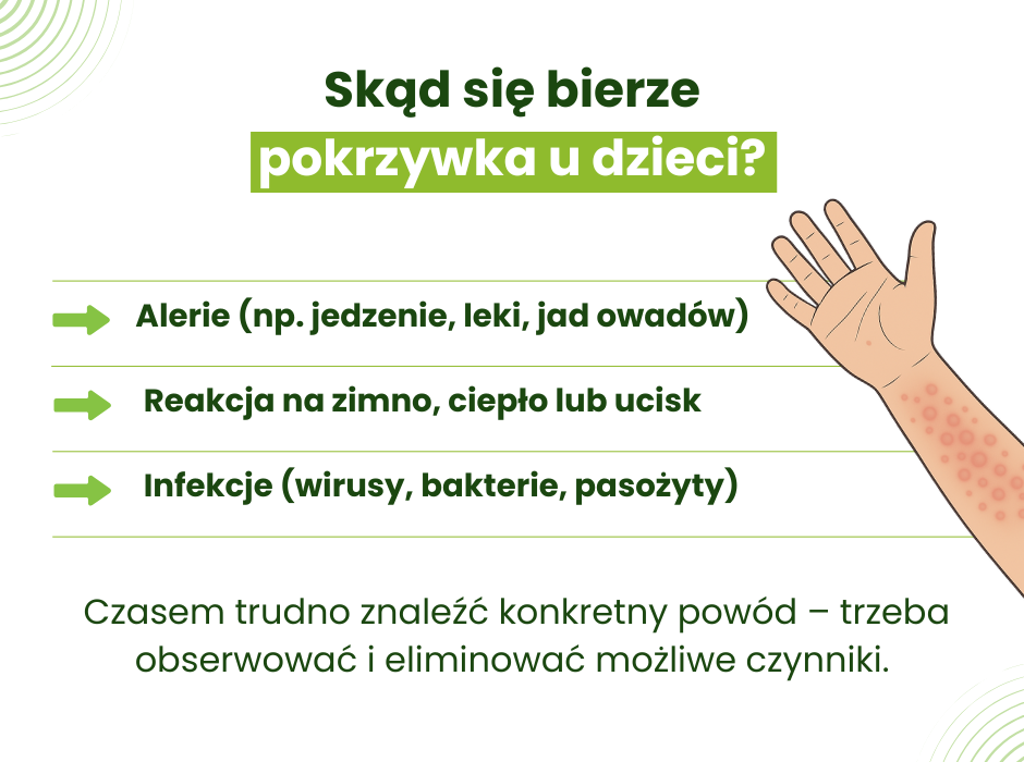 Pokrzywka u dzieci przyczyny - infografika