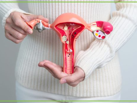 Endometrioza-objawy, przyczyny i leczenie - obrazek wyróżniający