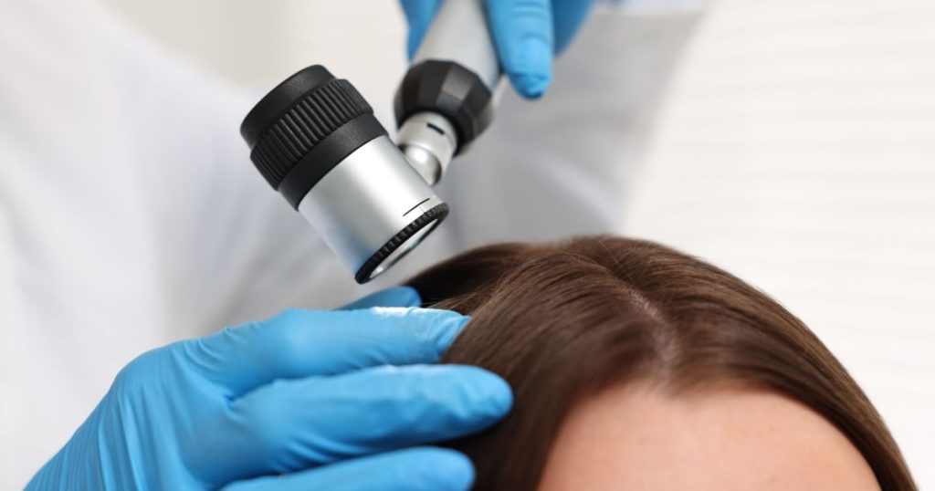 Diagnozowanie wypadających włosów - zdjęcie poglądowe