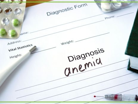 Anemia–czym jest, przyczyny, objawy i leczenie niedokrwistości - obrazek wyróżniający