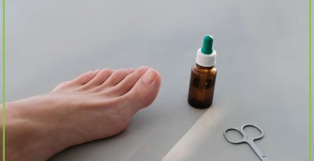 Onycholiza paznokci – co to jest i jak ją leczyć? - obrazek wyróżniający